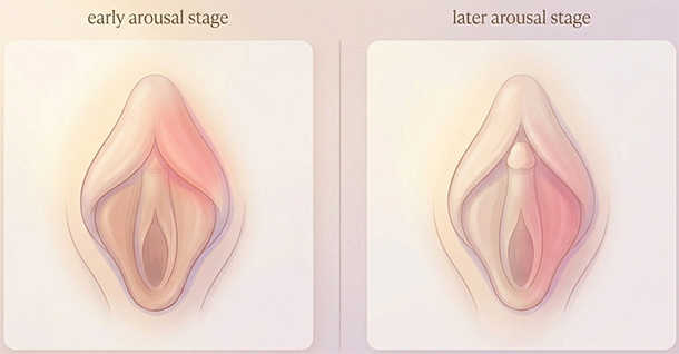 Before-and-after arousal illustration showing how clitoral sensitivity naturally shifts between sides.